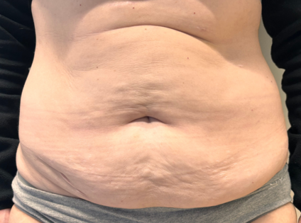 SSJ Abdo Before