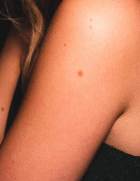 Why do people have it & Who is suittable
